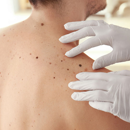 Dermatologia - Inova